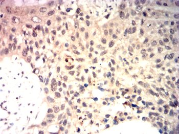 CDKN2B Antibody