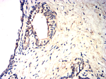 CDKN2B Antibody