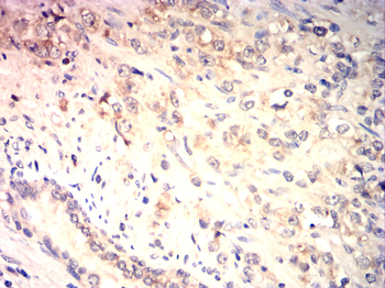 CDKN2B Antibody
