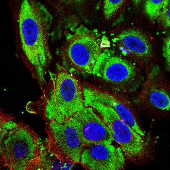 PDGFRA Antibody