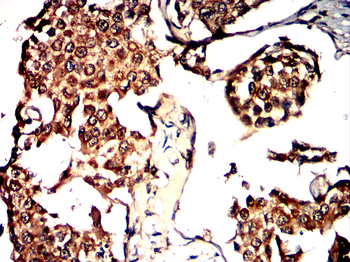 PDGFRA Antibody