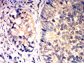 PDGFRA Antibody