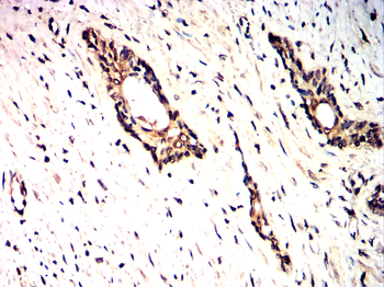 PDGFRA Antibody