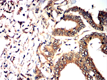 CD14 Antibody