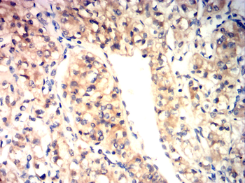 NOS2 Antibody