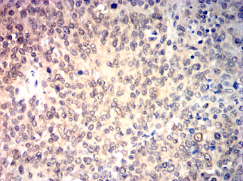 OTX2 Antibody