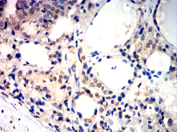 OTX2 Antibody