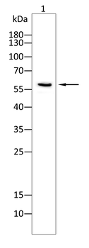 ALPP Antibody