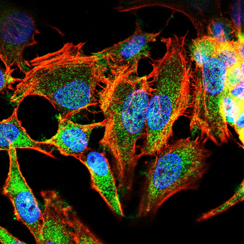 ITGB3 Antibody
