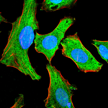DNMT3A Antibody
