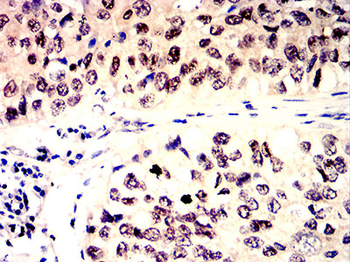 DNMT3A Antibody
