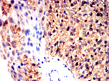 IGF2 Antibody