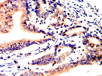IGF2 Antibody