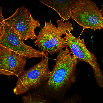 BMP2 Antibody