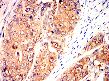 BMP2 Antibody