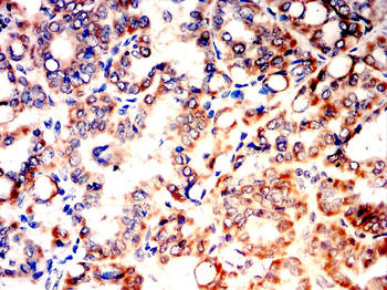 BMP2 Antibody