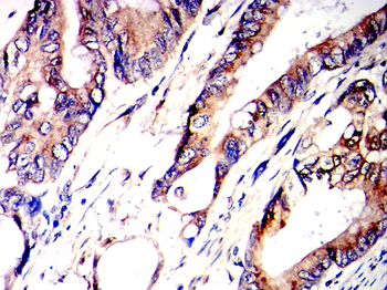 BMP2 Antibody