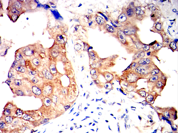 BMP2 Antibody