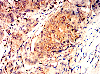 GAP43 Antibody