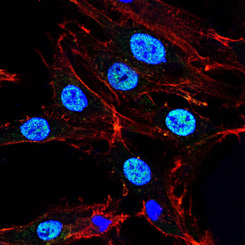 PMS2 Antibody