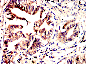 CCNB1 Antibody