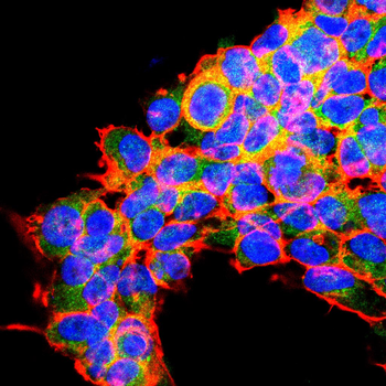 TSPO Antibody