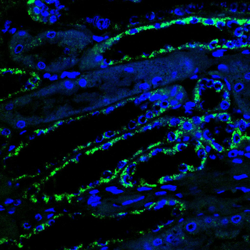 TSPO Antibody