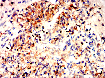 TSPO Antibody