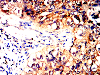 MMP12 Antibody