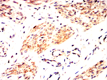MMP12 Antibody