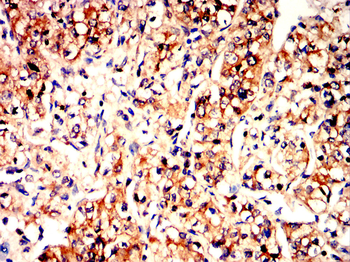 MMP12 Antibody