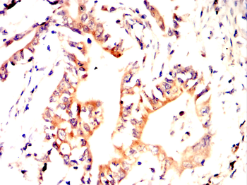 MMP12 Antibody