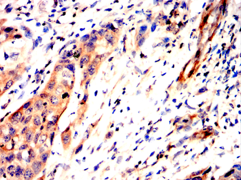 VCAM1 Antibody