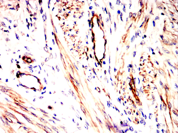 VCAM1 Antibody