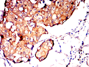 CD8A Antibody