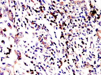 CD8A Antibody