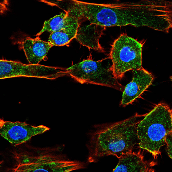 WT1 Antibody