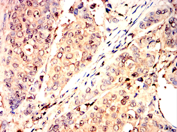 WT1 Antibody