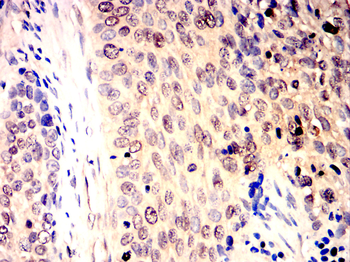 WT1 Antibody