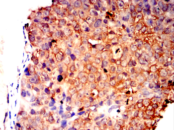 WT1 Antibody