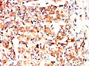 WT1 Antibody