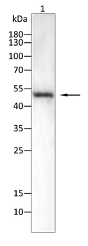 WT1 Antibody