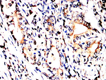 CD81 Antibody