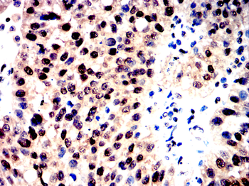 GSDMD Antibody