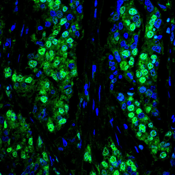 GSDMD Antibody