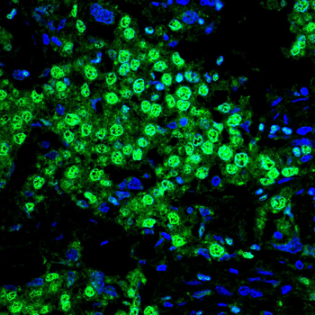 GSDMD Antibody