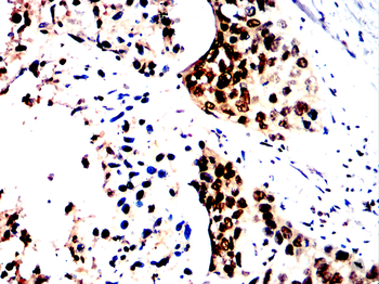 GSDMD Antibody