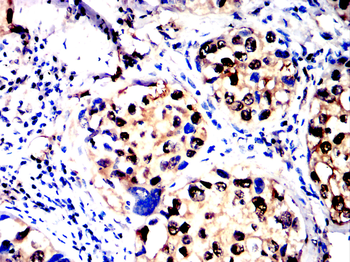 GSDMD Antibody