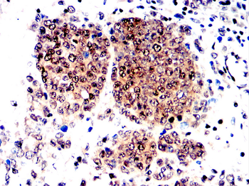 GSDMD Antibody