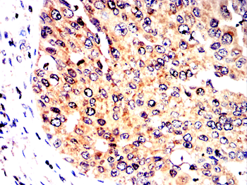 GSDMD Antibody
